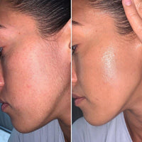 Luxevéria Silky Smooth Hair Removal Cream™